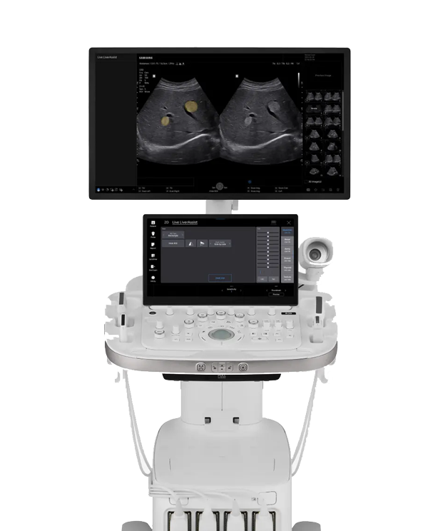 삼성 최고 사양 r20 초음파